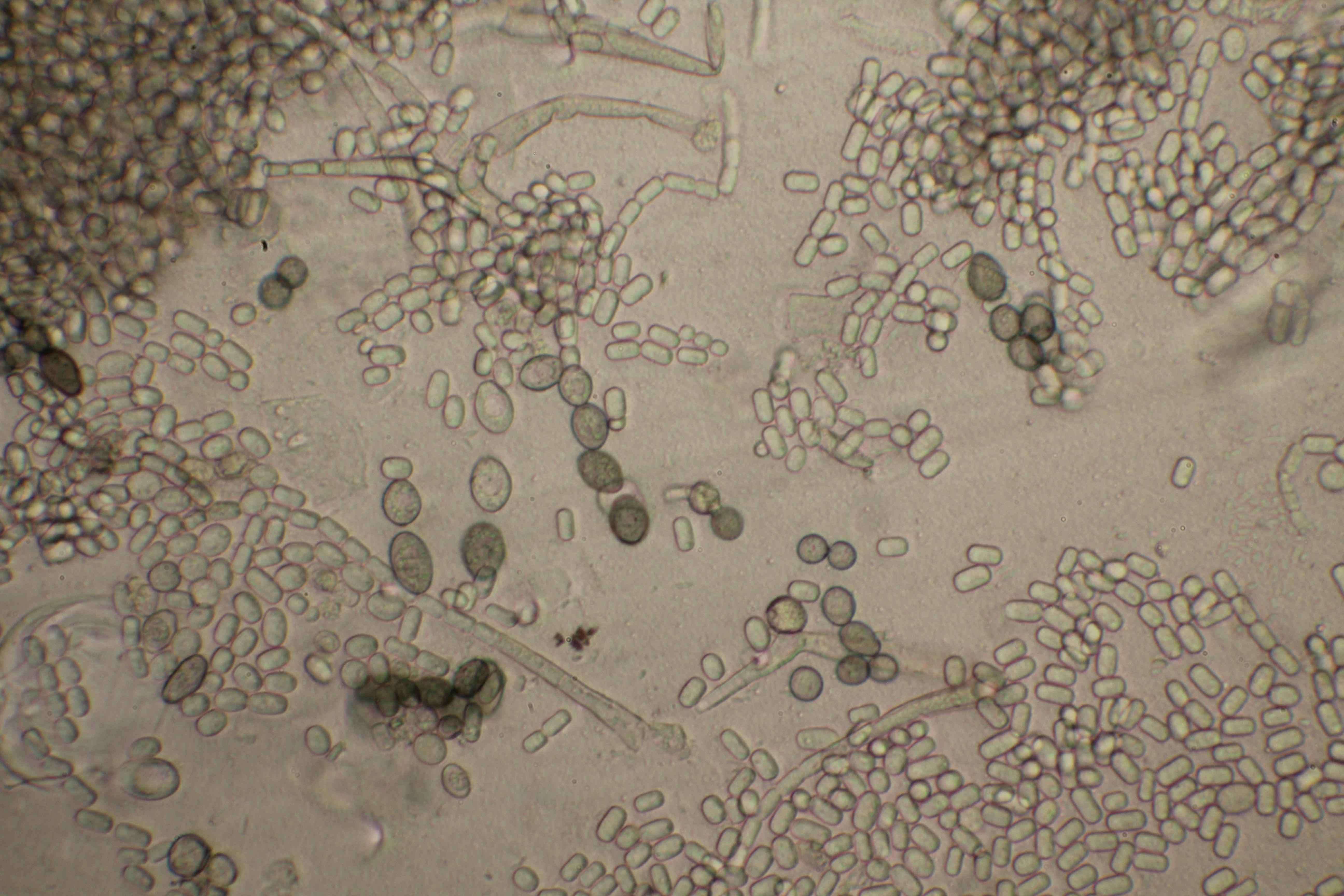 菠萝病虫害绿色防控技术